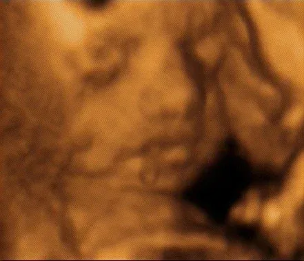 4D Sonography image 1