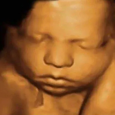 4D Sonography image 2