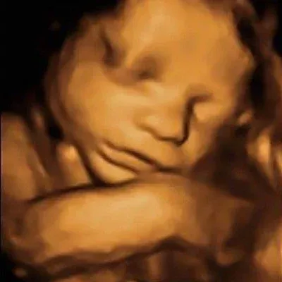 4D Sonography image 3