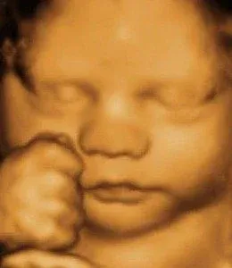 4D Sonography image 4